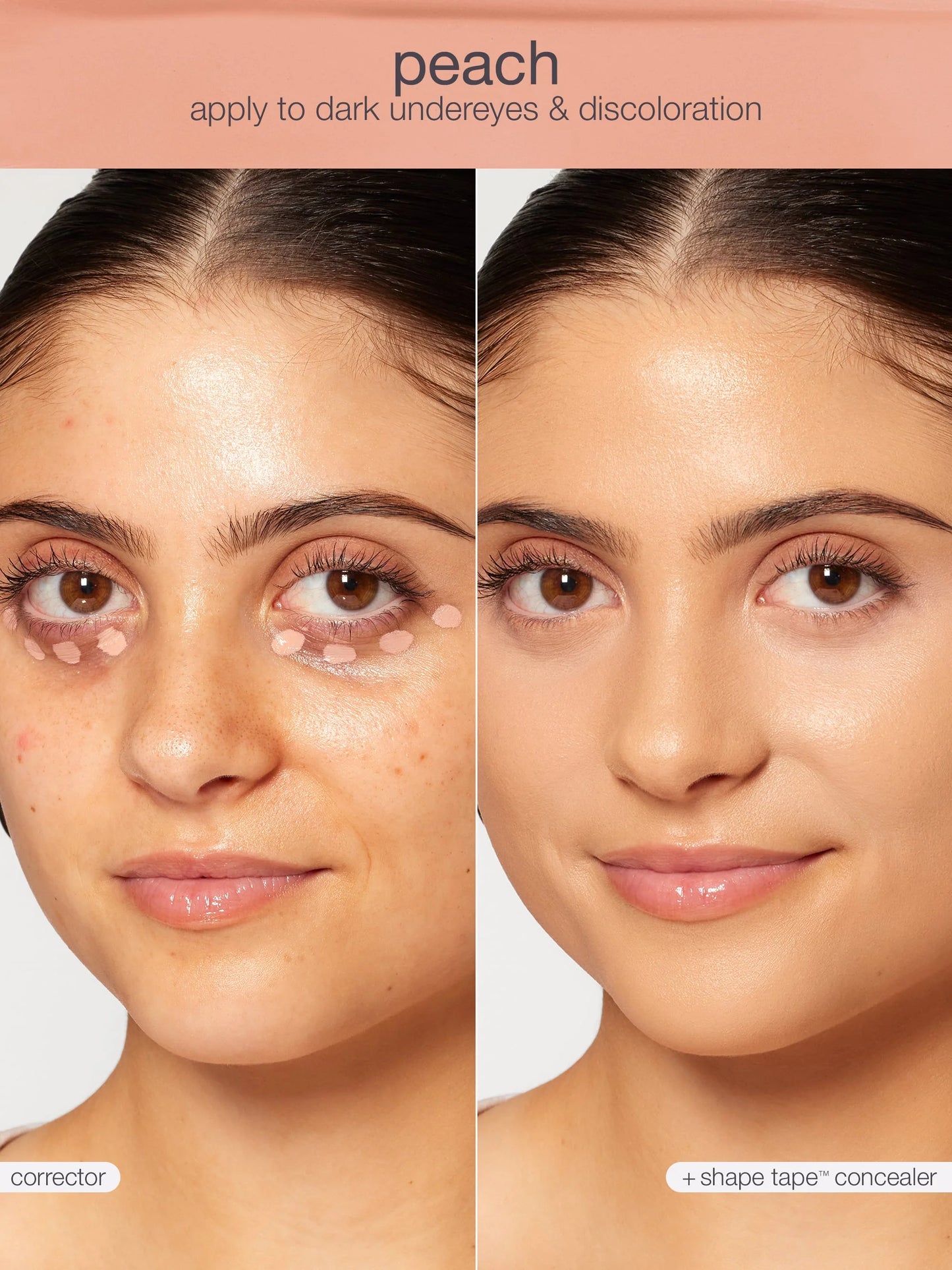 shape tape™ corrector