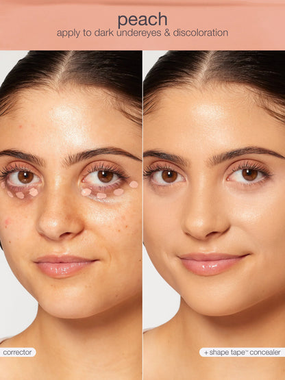 shape tape™ corrector